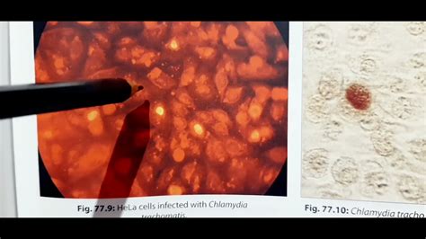 The Laboratory Diagnosis of Chlamydia Infections .